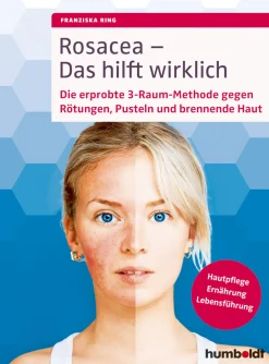 Waschbär Rosacea - Das hilft wirklich: Die erprobte 3-Raum-Methode gegen Rötungen, Pusteln und brennende Haut : Hautpflege, Ernährung, Lebensführung. Outlet